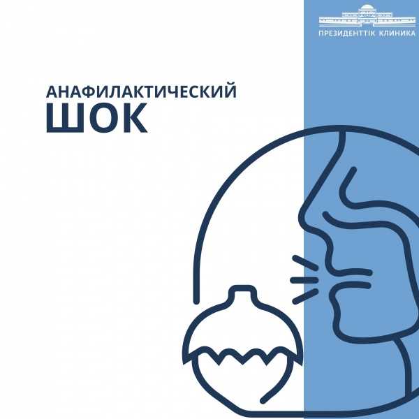 Профилактика анафилактического шока: как избежать угрозы